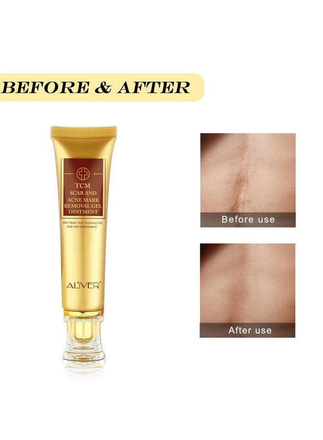 3 Pack Scar Removal Creamtcm Scar Cream For Surgical Scars Acne Skin Care Cream Acne Treatment Cream For Scars Burns Stretch Marks Acne Spots