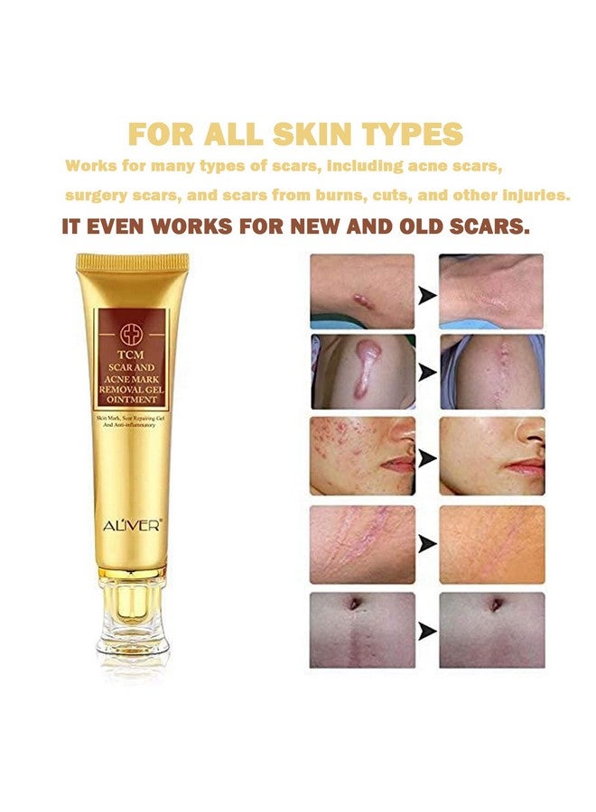 3 Pack Scar Removal Creamtcm Scar Cream For Surgical Scars Acne Skin Care Cream Acne Treatment Cream For Scars Burns Stretch Marks Acne Spots
