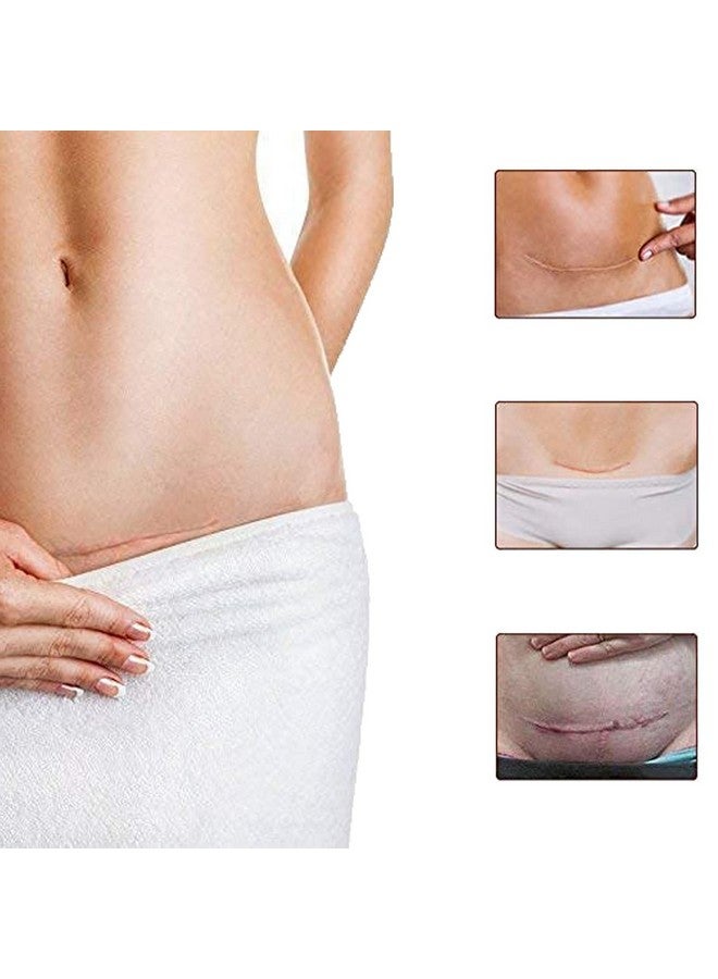 3 Pack Scar Removal Creamtcm Scar Cream For Surgical Scars Acne Skin Care Cream Acne Treatment Cream For Scars Burns Stretch Marks Acne Spots