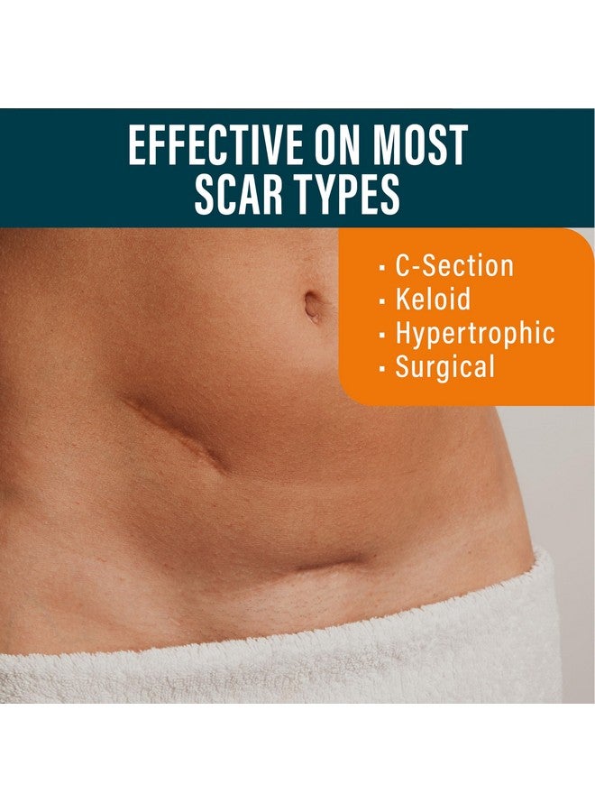 Silicone Scar Sheets Extra Long Scar Sheets For Csection Tummy Tuck Keloid And Surgical Scars Reusable Medical Grade Silicone Scar Sheets Pack Of 4 Medium Tone