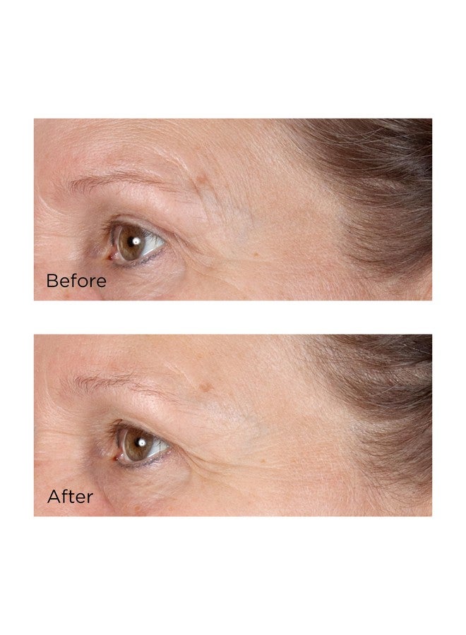 Vitamin C Ester Daily Brightening & Exfoliating Peel 2 Fl. Oz.