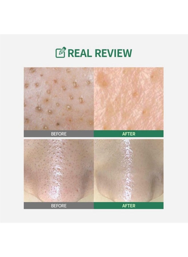 Green Tomato Pore Peeling Jumbo Pad 60 Sheets | Facial Toner Pads For Minimizing Pores & Soothing & Deep Hydration | Pha Hyaluronic Acid | Korean Skincare