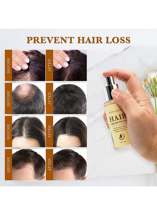 Biotin & Castor Oil & Rosemary Oil For Hair Growth For Women, Hair Loss Treatments For Dry Damaged Hair And Growth, Serum For Thicker Longer Fuller Healthier Hair, All Natural Vitamin Rich Treatment