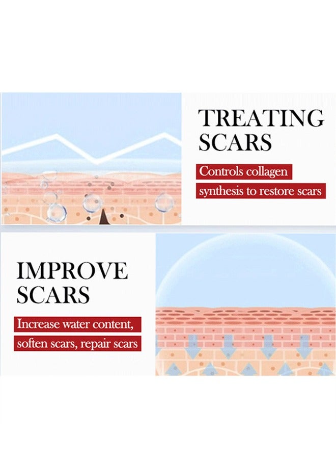 Tratamiento De Las Cicatrices, Advanced Formula Scar Treatment Gel 15g, Helps Soften And Smooth Raised Scars, Maintaining The Moisture Balance of The Adjacent Skin, Reduces Discolouration, Redness, Pa