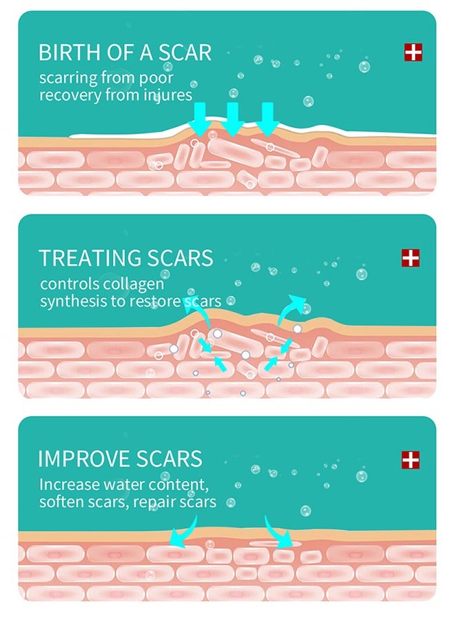 Tratamiento De Las Cicatrices, Advanced Formula Scar Treatment Gel 15g, Helps Soften And Smooth Raised Scars, Maintaining The Moisture Balance of The Adjacent Skin, Reduces Discolouration, Redness, Pa