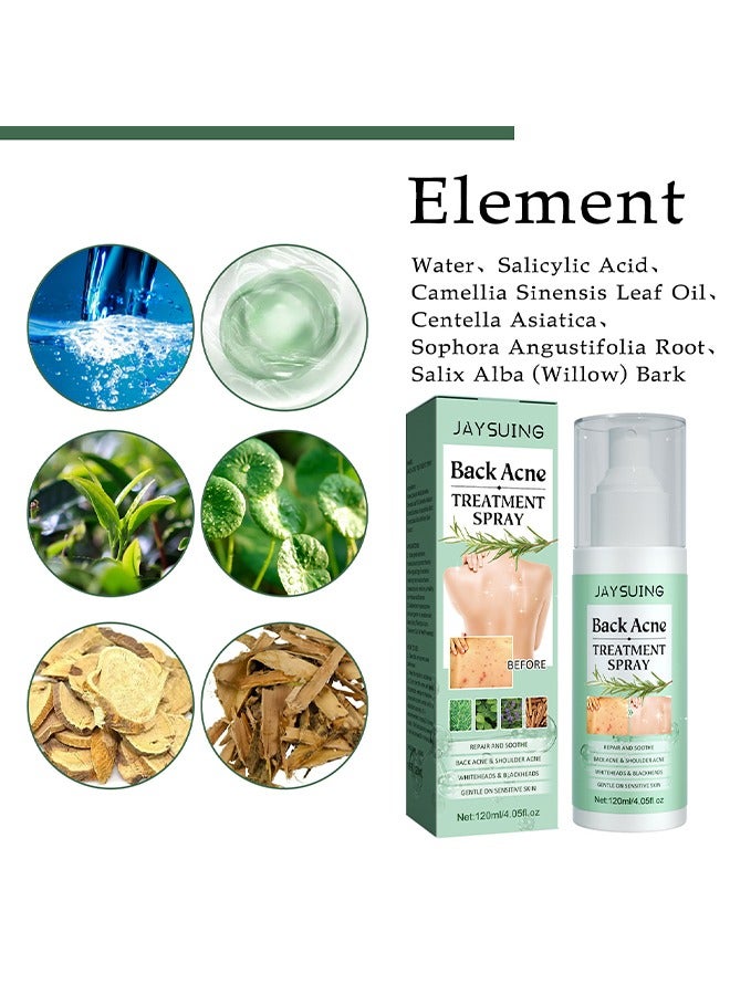 Back Acne Treatment Spray , Lighten Acne Marks Repair Back Shoulder Acne Skin,2% Salicylic Acid and Tea Tree Oil Spray 120ml