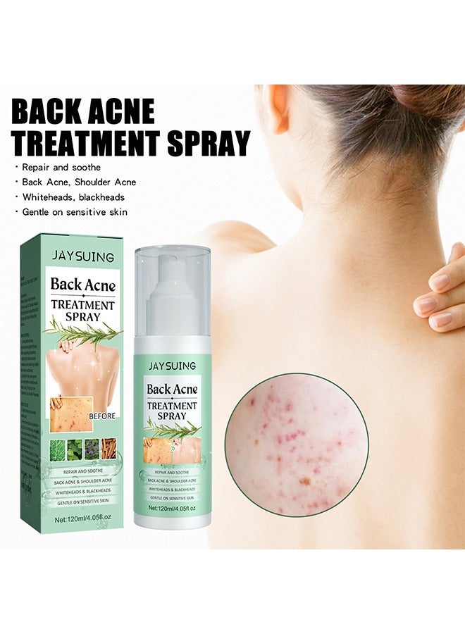Back Acne Treatment Spray , Lighten Acne Marks Repair Back Shoulder Acne Skin,2% Salicylic Acid and Tea Tree Oil Spray 120ml