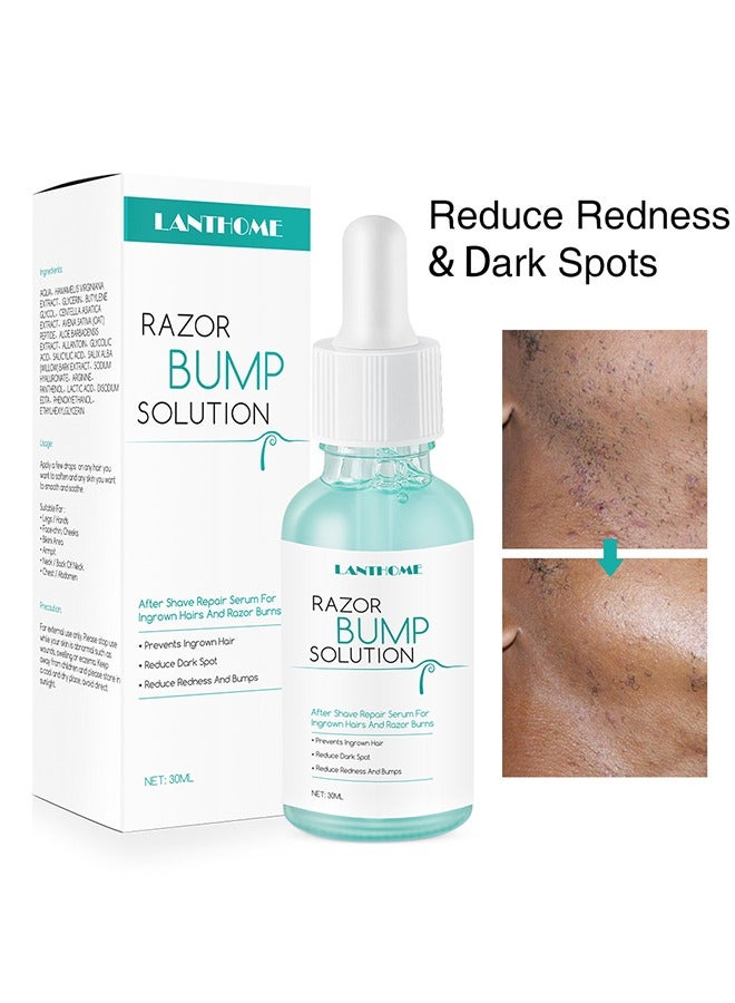 Razor Bump Solution,Hair Growth Inhibitor Safe and Gentle Repair serum, Delay Hair Growth, No Black Spots 30ml