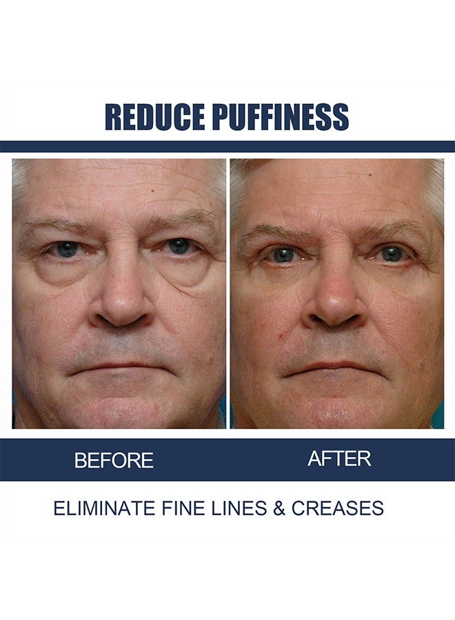 Men Eye Cream Anti Aging 15g，Fight Against Wrinkles And Signs 15g Of Aging Around The Eyes, Boosts Hydration，Reduces Puffiness，Lightens Dark Circles, Suitable For All Skin Types