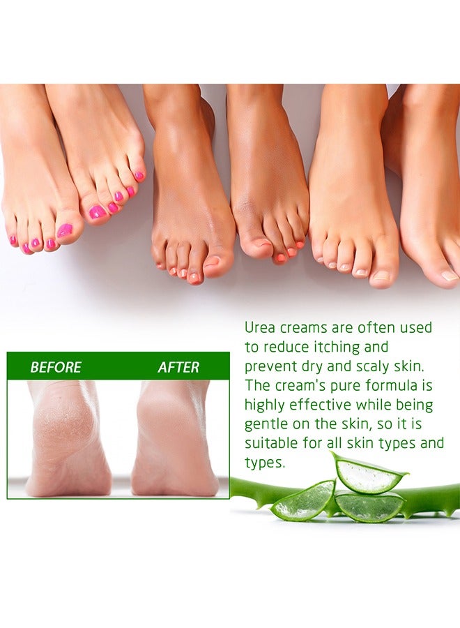 Foot Care Cream Allantoin 40% Cream For Cracked,Rough Thick and Dry Skin Soothes and Softens Feet,Elbows and Knees Hydrating and Moisturizing Foot Care Cream 100g