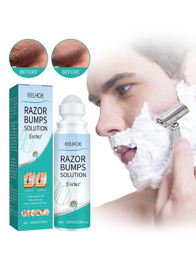 Razor Bump Solution，Prevents Ingrown Hair  Reduce Dark Spot Reduce Redhess And Bumps，Hair Growth Inhibitor Safe and Gentle, Delay Hair Growth, No Black Spots，Roll-on 100ml