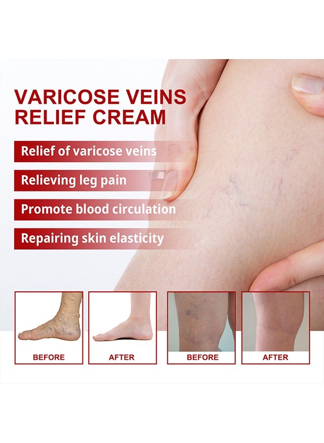 Varicose Veins Cream，Relieve Tired Legs Relieve Dilated Capillaries Minimize Varicose &Spider Veins ​Relief Cream 20g