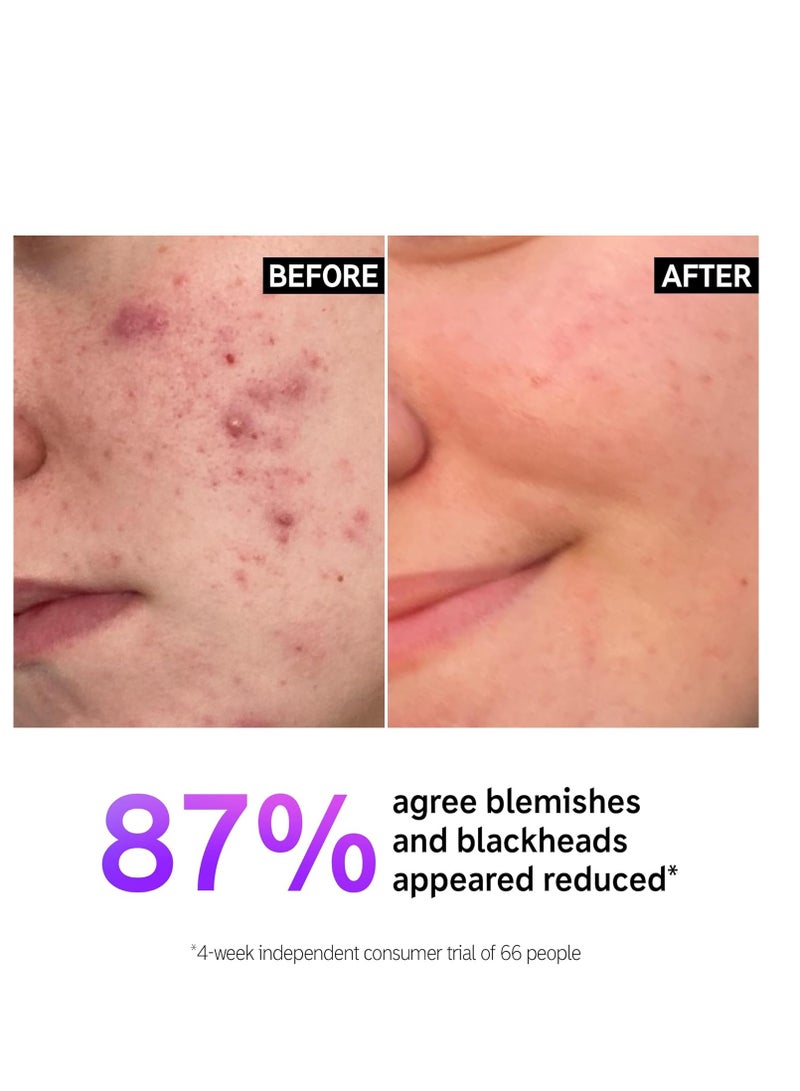 The INKEY List Salicylic Acid Cleanser, Face Wash for Blemishes, Blackheads, Oily Skin and Breakouts, Non-Drying Facial Cleanser Safe for All Skin Types, 5.0 fl oz