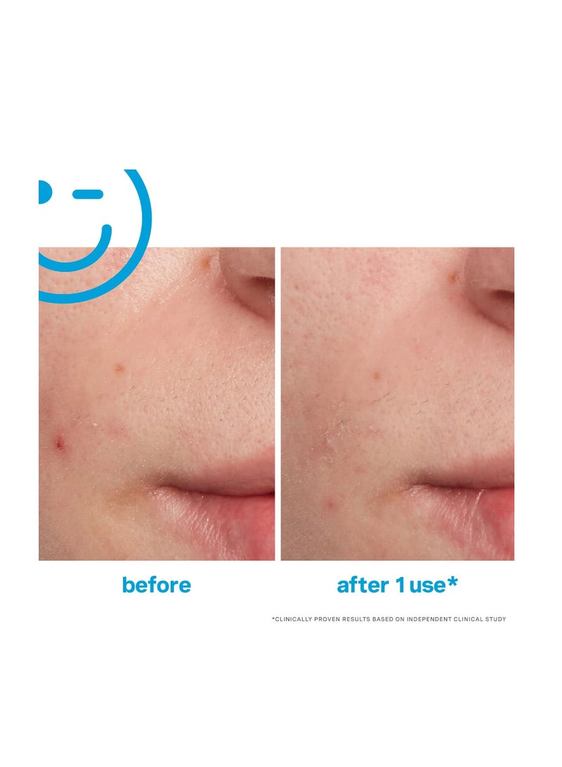 Kate Somerville EradiKate Acne Treatment - Clinically Formulated 10% Sulfur and BHA Spot Treatment – Clears Pimples, Cleans Pores and Prevents Breakouts, 1 Fl Oz