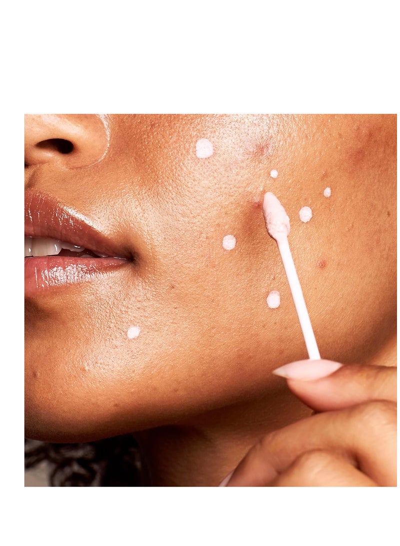 Kate Somerville EradiKate Acne Treatment - Clinically Formulated 10% Sulfur and BHA Spot Treatment – Clears Pimples, Cleans Pores and Prevents Breakouts, 1 Fl Oz