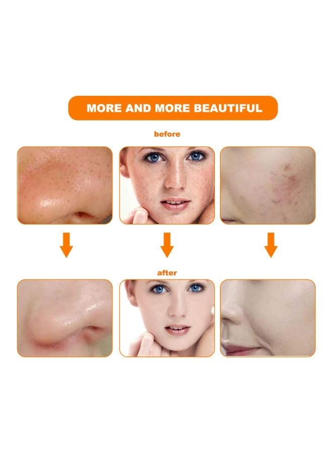 Colour Optical Whitening Face Mask With Remote Kit White/Black 230x200mm