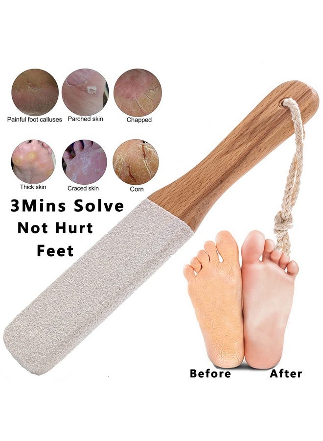 Callus Remover Foot Scrubber Colossal Foot File Foot Care And Foot Exfoliator Foot Rasp Pedicure Tools Pumice Stone For Feetremove Corn Hard Skin Dead Skin For Use In Shower Foot Scraper Kit