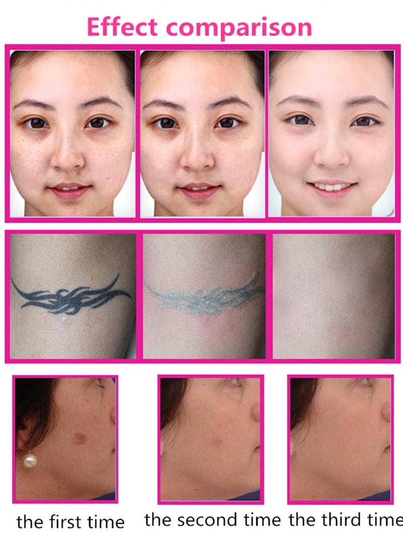 Laser Tattoo Removal Machine Picosecond pen Freckle Remover Mole Dark Spot Eyebrow Pigment Acne blue light Treatment