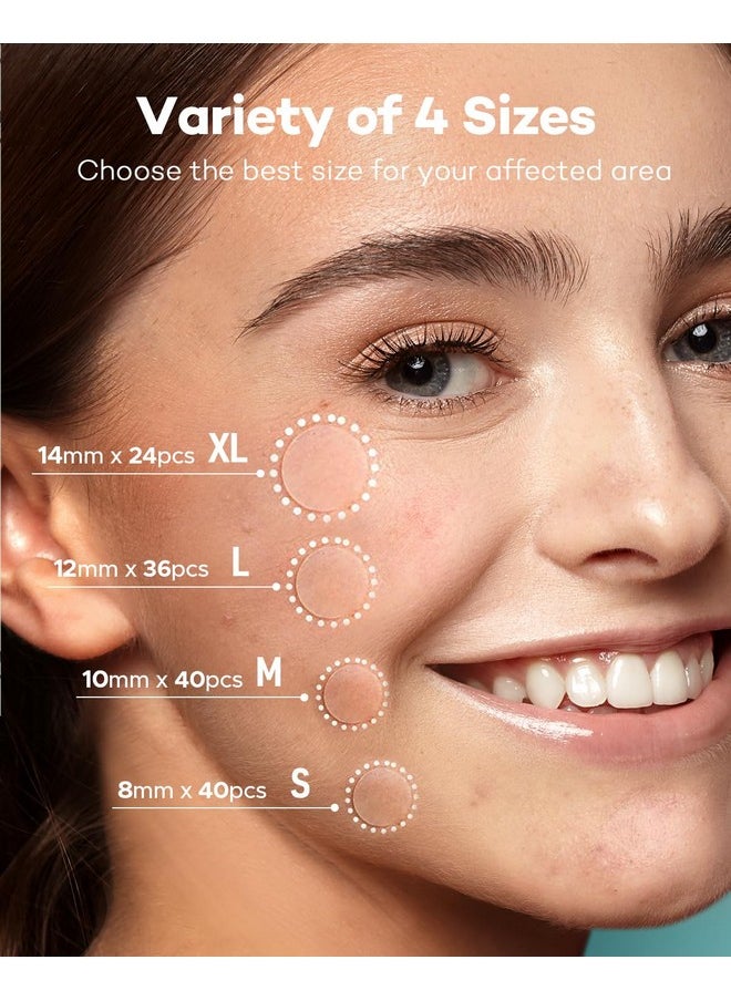 Acne Patch Pimple Patch, 4 Sizes 140 Patches Acne Absorbing Cover Patch, Hydrocolloid Invisible Acne Patches For Face Zit Patch Acne Dots Tea Tree, Calendula Oil