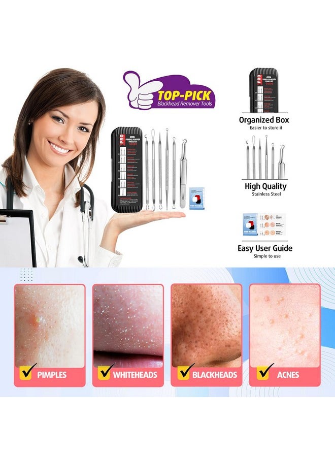 Blackhead Remover Tools, Pimple Popper Tool Kit, Blackhead Extractor Tool, Zit Popper Tool, Professional Pimple Extractor Tool For Blackhead, Acne, Whitehead, Comedone On Nose - With Case