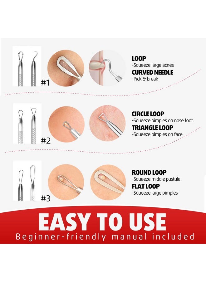 Blackhead Remover Tools, Pimple Popper Tool Kit, Blackhead Extractor Tool, Zit Popper Tool, Professional Pimple Extractor Tool For Blackhead, Acne, Whitehead, Comedone On Nose - With Case