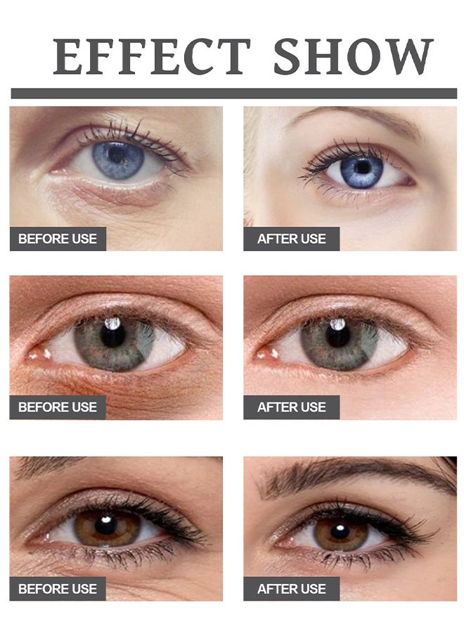 Peptide Anti Aging Eye Serum 20G, Anti-Aging And Remove Wrinkles Eye Serum, With Three 360° Massage Ball, Eye Cream With Anti Allergy Applicatorhead, Firming Lifting Eye Essence, Eye Care