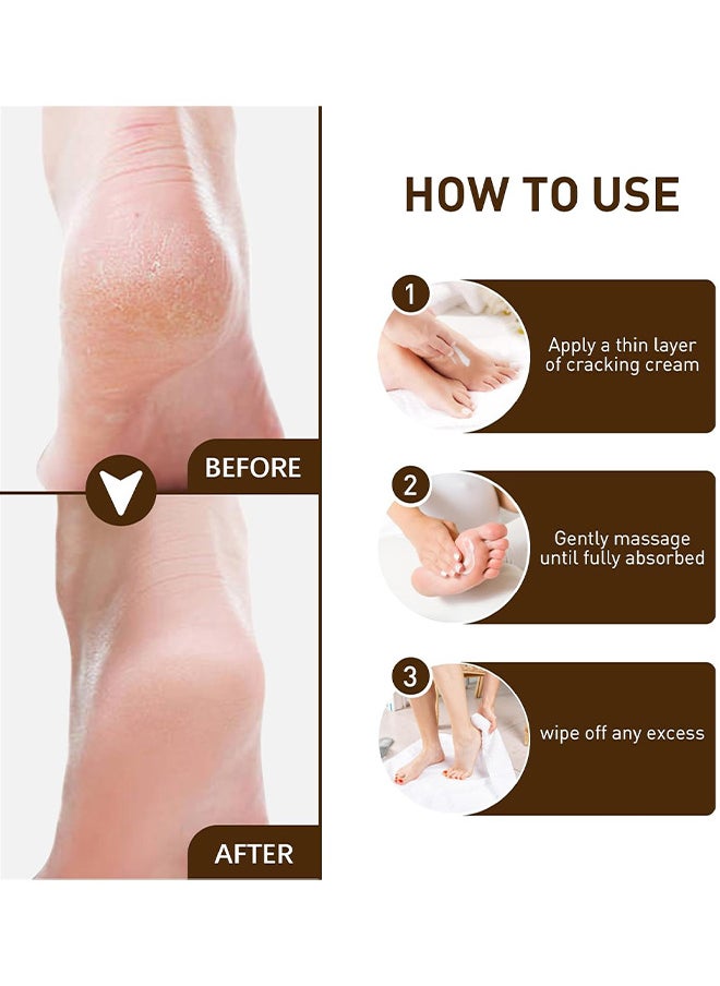 Whitening Repair Foot Cream, Cracked Heel Cream Foot Care Collagen Milk Whitening Repair Foot Cream Rough Dry Skin Baby Foot 100G