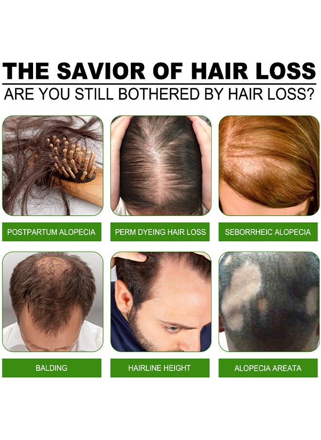 Green Ginger Hair Regrowth Spray, Hair Nourishing Growth Spray, Moisturizing Fast Growth Anti-Defixation Spray Growth Solution, Organic Growth Plus Nourishing Ginger Spray For Men And Women, 100ML