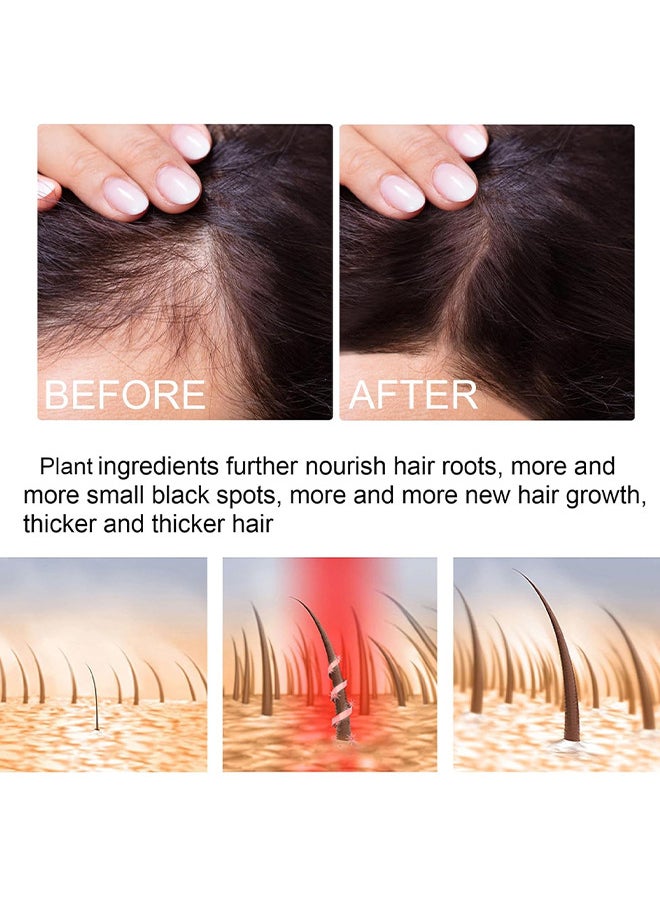 Green Ginger Hair Regrowth Spray, Hair Nourishing Growth Spray, Moisturizing Fast Growth Anti-Defixation Spray Growth Solution, Organic Growth Plus Nourishing Ginger Spray For Men And Women, 100ML