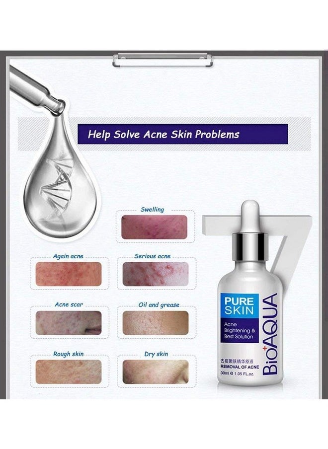 4In1 Face Acne Treatment Scar Removal Spots Pimples Oil Cream Face Masks Scar Blemish Marks Moisturizing Oil 100G+30G+30Ml+4Pcs X30G