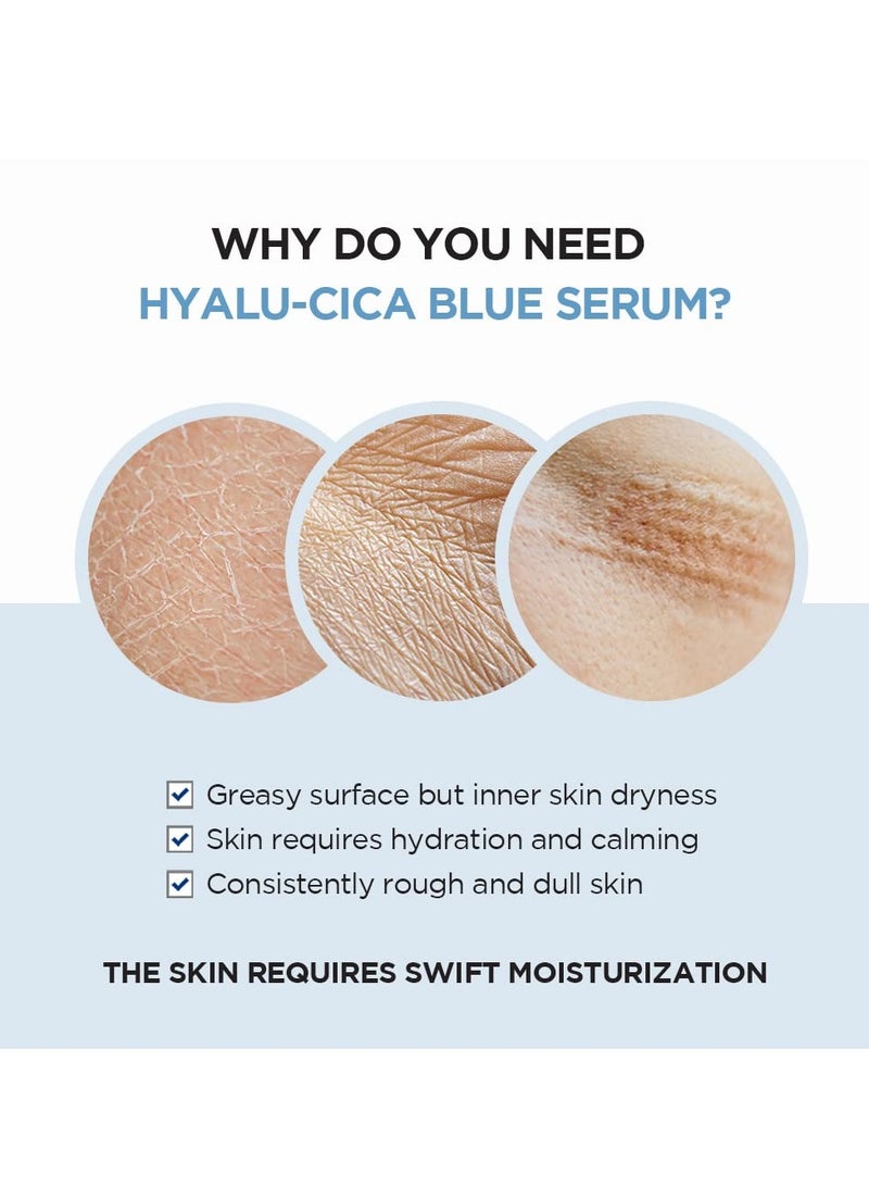 Hyalu-CICA Blue Serum 1.69 fl.oz, 50ml, 5 Layer Hyaluronic Acid Cica Niacinamide, Hydrating and Refreshing Multi-Care Solutions Blue