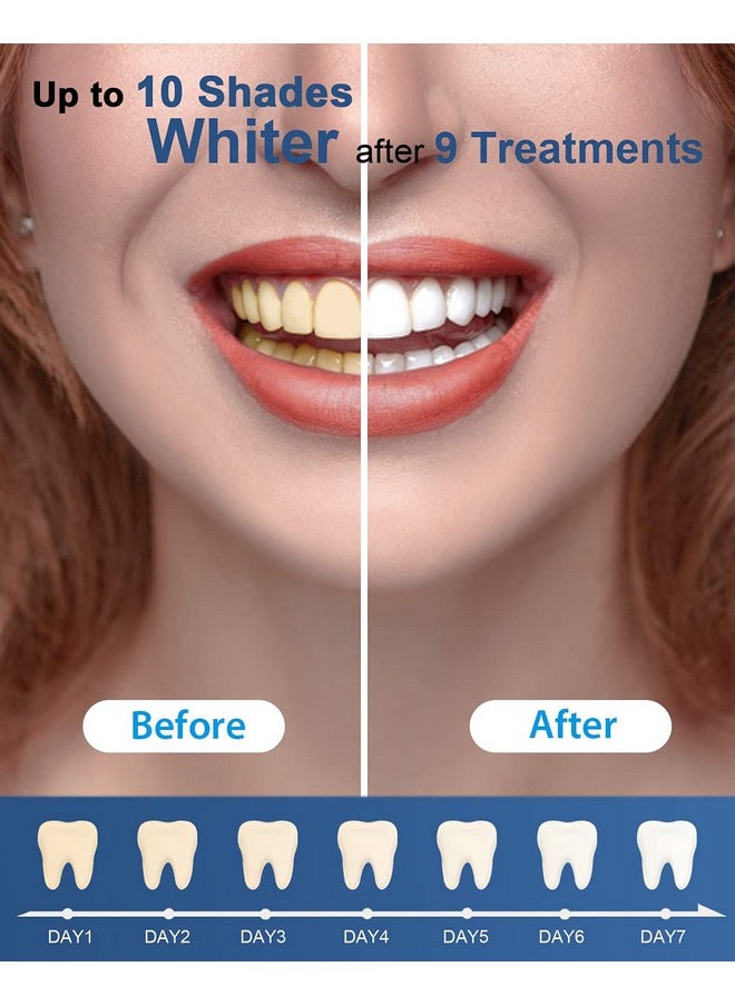 Teeth Whitening Gel Refills Pack, 6 Non-Sensitive Teeth Whitening Gel Pen, Teeth Whitener Dental Grade Tooth Whitening Gel For Tray, 10 Min Fast Result Whitening