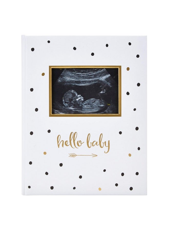 Hello Baby First 5 Years Memory Book, Gender-Neutral Baby Keepsake For New And Expectant Parents, Pregnancy And Milestone Journal, Modern Minimalist Black And Gold Polka Dot