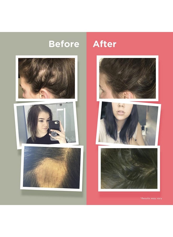 Hairanew Hair Growth Vitamins For Women & Men - Hair Vitamins For Faster Hair Growth & Thickness - Part Of Proceeds Go To Hair Loss Charity - Vegan Hair Supplement For Hair Skin Nails (1)