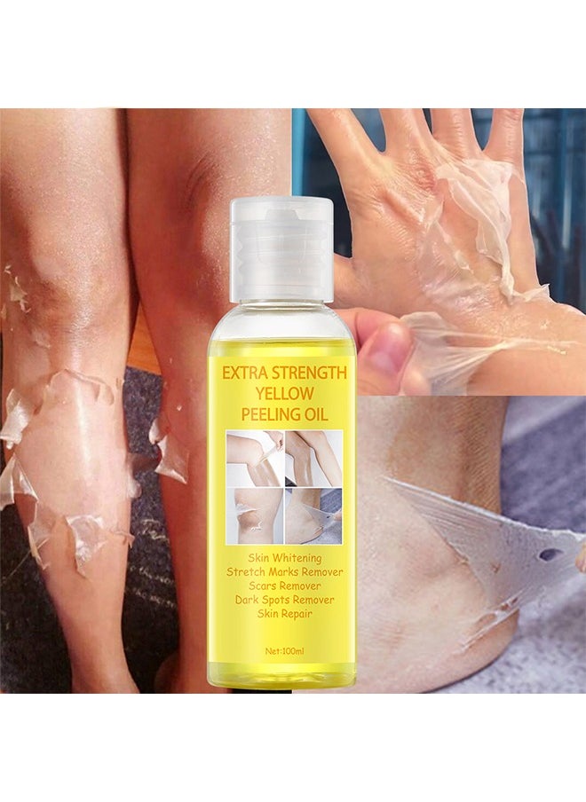 Extra Strength Yellow Peeling Oil-Skin Whitening, Stretch Marks Remover, Scars Remover, Dark Spots Remover, Skin Repair 100ml