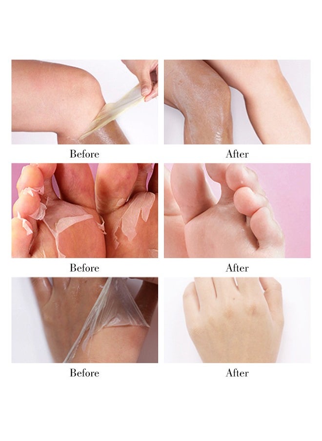 Extra Strength Yellow Peeling Oil-Skin Whitening, Stretch Marks Remover, Scars Remover, Dark Spots Remover, Skin Repair 100ml