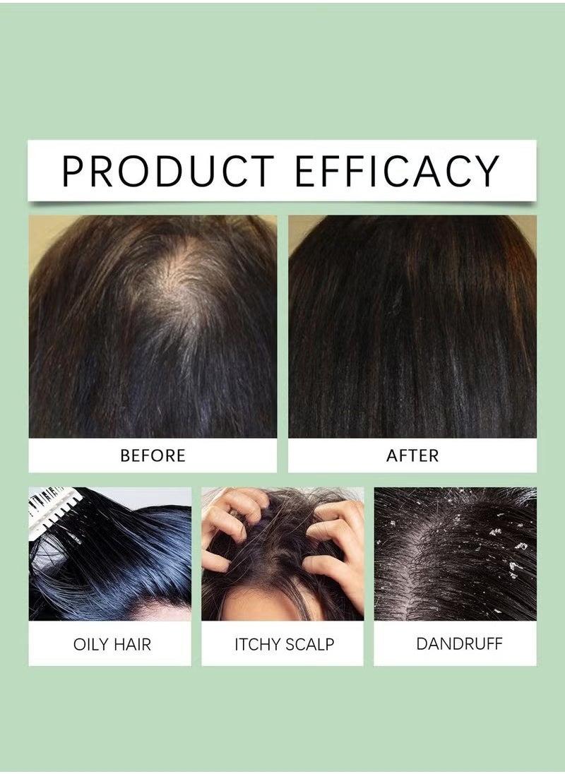 Rosemary Scalp Scrub with Scalp Scrubber Set, Contains Rosemary, Peppermint Oil, and Petrel Ingredients Scalp Exfoliator Scrub, Scalp Cleanser for Relieve Scalp Itching, Exfoliate and Care for Scalp and Hair