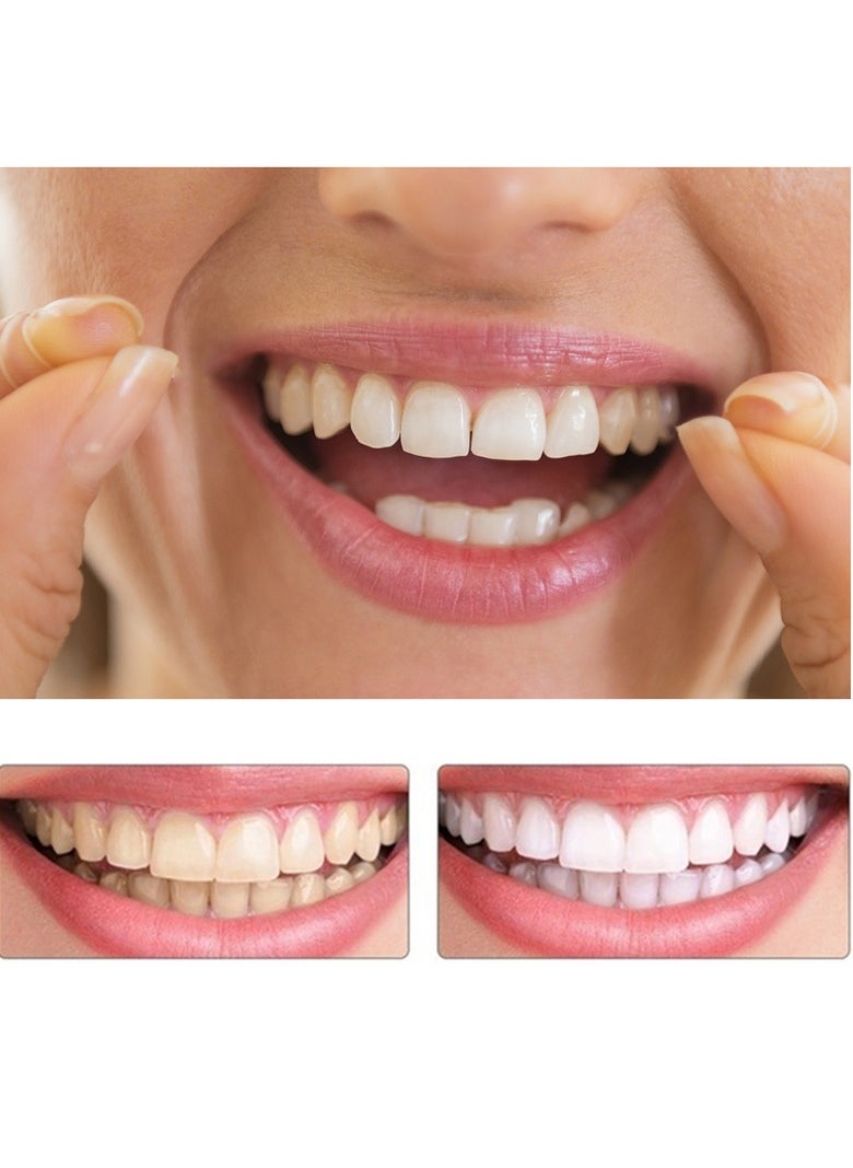 Teeth Veneers Anti-true Braces Snap On Smile Teeth Whitening Denture Teeth Comfortable Veneer Cover Teeth