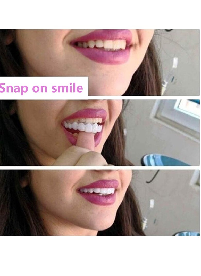 Teeth Veneers Anti-true Braces Snap On Smile Teeth Whitening Denture Teeth Comfortable Veneer Cover Teeth