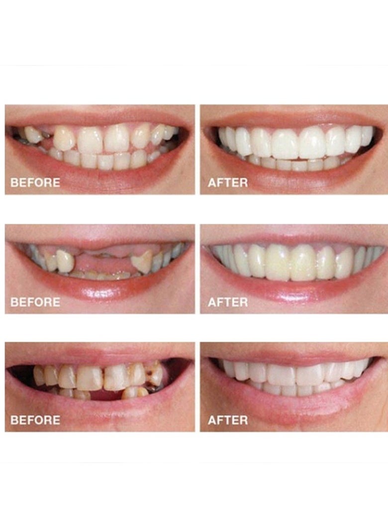 Teeth Veneers Anti-true Braces Snap On Smile Teeth Whitening Denture Teeth Comfortable Veneer Cover Teeth