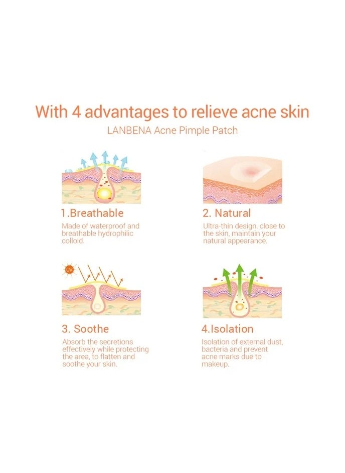 Acne Pimple Patch Acne Removal Acne Stickers Blemish Treatment Face Skin Care Pimple Remover Tool 25 Patches for Daily Use 2 Pack