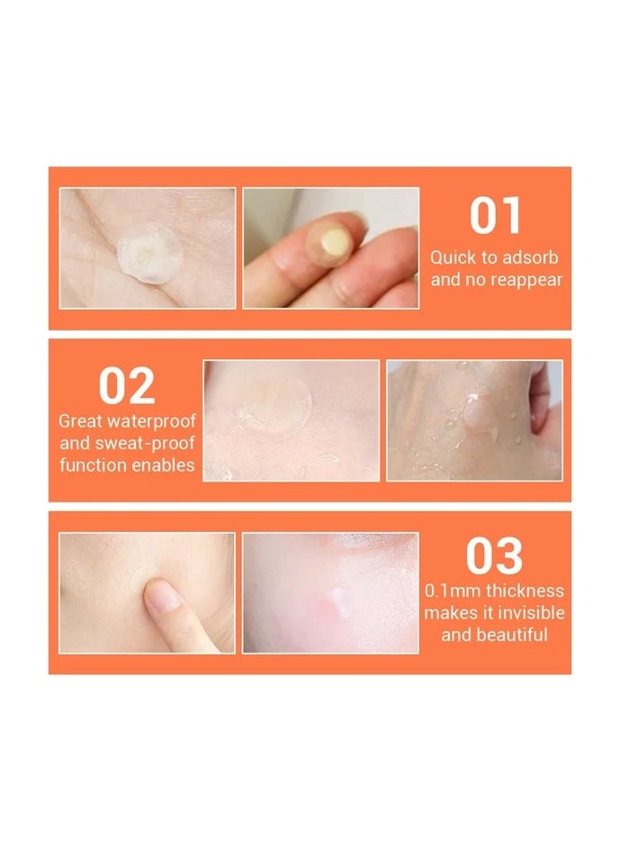 Acne Pimple Patch Acne Removal Acne Stickers Blemish Treatment Face Skin Care Pimple Remover Tool 25 Patches for Daily Use 2 Pack