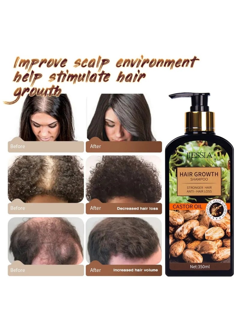 350ml Castor Oil Hair Growth Shampoo for Hair Growth and Increase Thickness Repair Dry and Damaged Hair Anti Hair Loss Shampoo Strengthens Hydrates Prevent Hair Breakage Castor Oil Shampoo