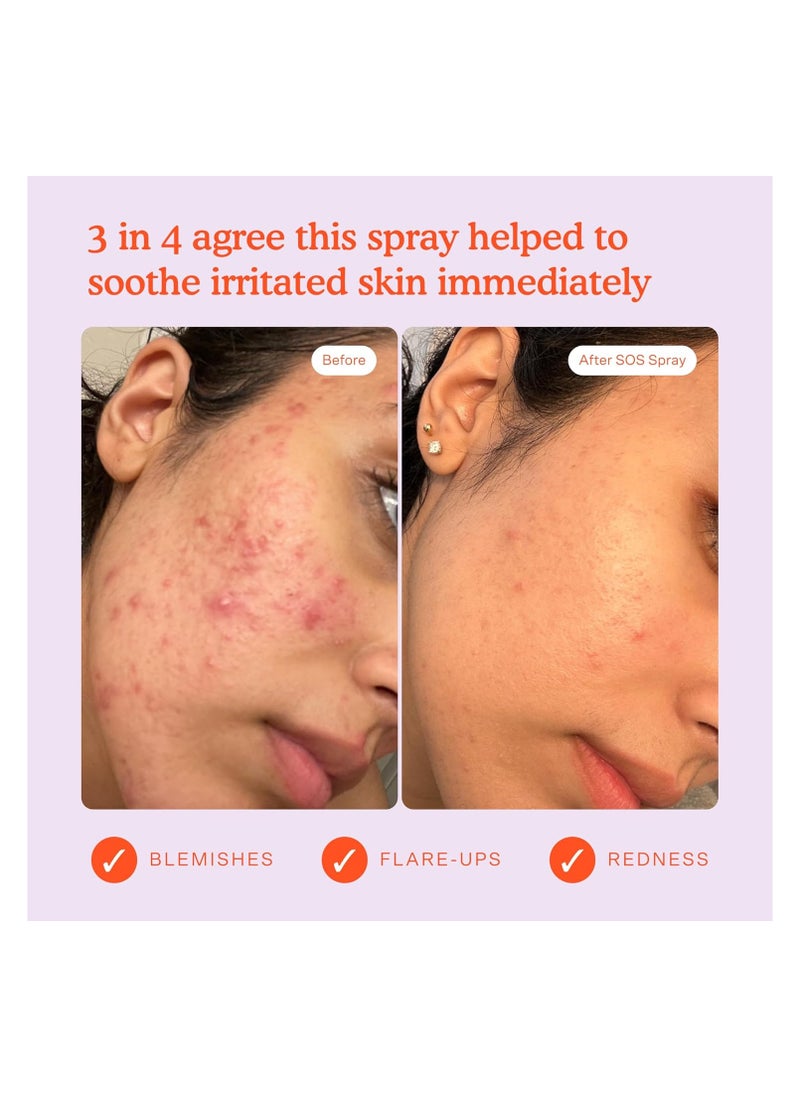 SOS Daily Rescue Facial Spray 1oz