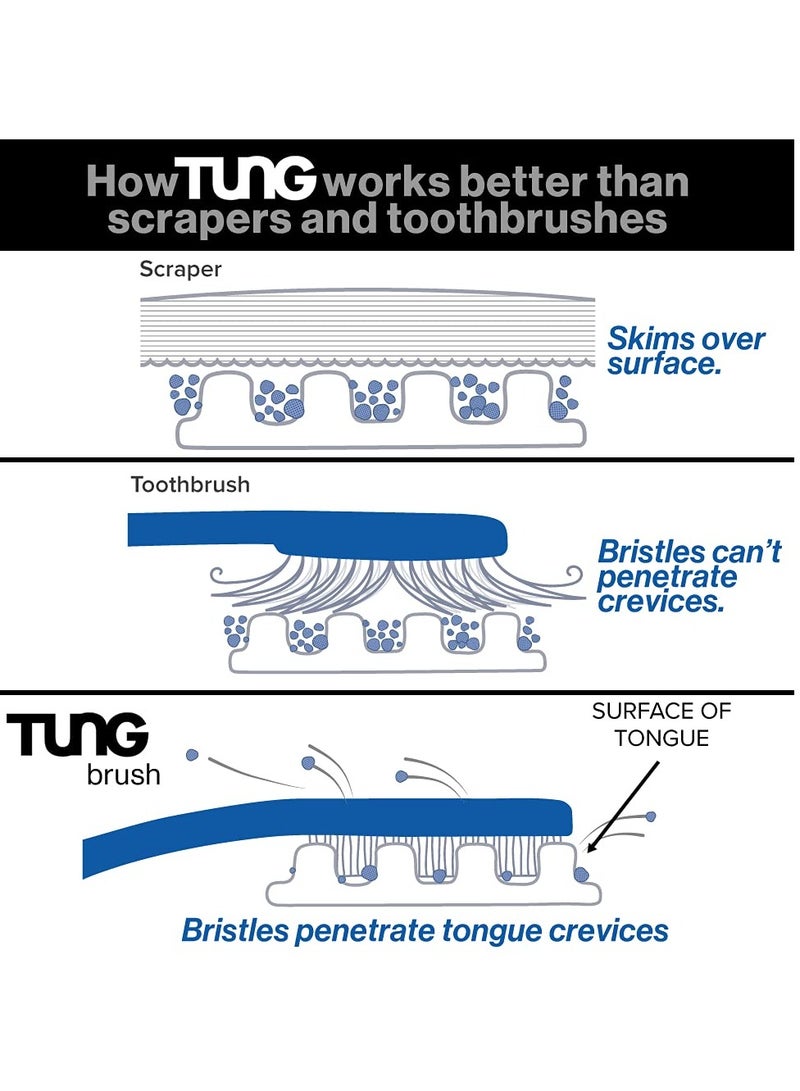Tung Tongue Brush & Gel Kit | Tongue Cleaner for Adults | Tongue Scraper to Fight Bad Breath and Halitosis | Mouth Odor Eliminator | Fresh Mint | Made in America (Set of 1)