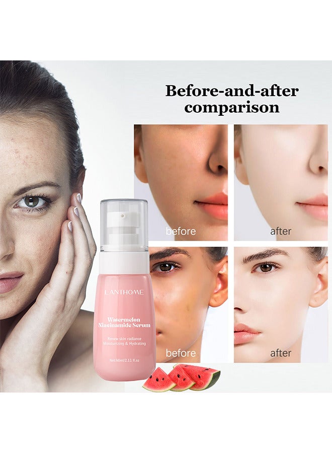 Watermelon Niacinamide Serum, Moisturizing Watermelon Toner Hyaluronic Facial Serum Multi Purpose Lightweight Face Highlighter, Brighten Liquid Highlighter For Skin Care, 60ML