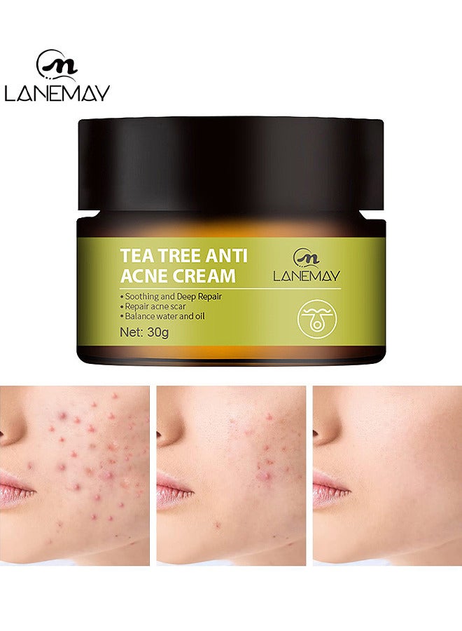 Natural Tea Tree Anti Acne Cream, Soothing And Deep Repair, Repair Acne Scar Balance, Natural Cystic Acne Treatment, Natural Cystic Acne Treatment Suitable For Oily And Acne Prone Skin 30G