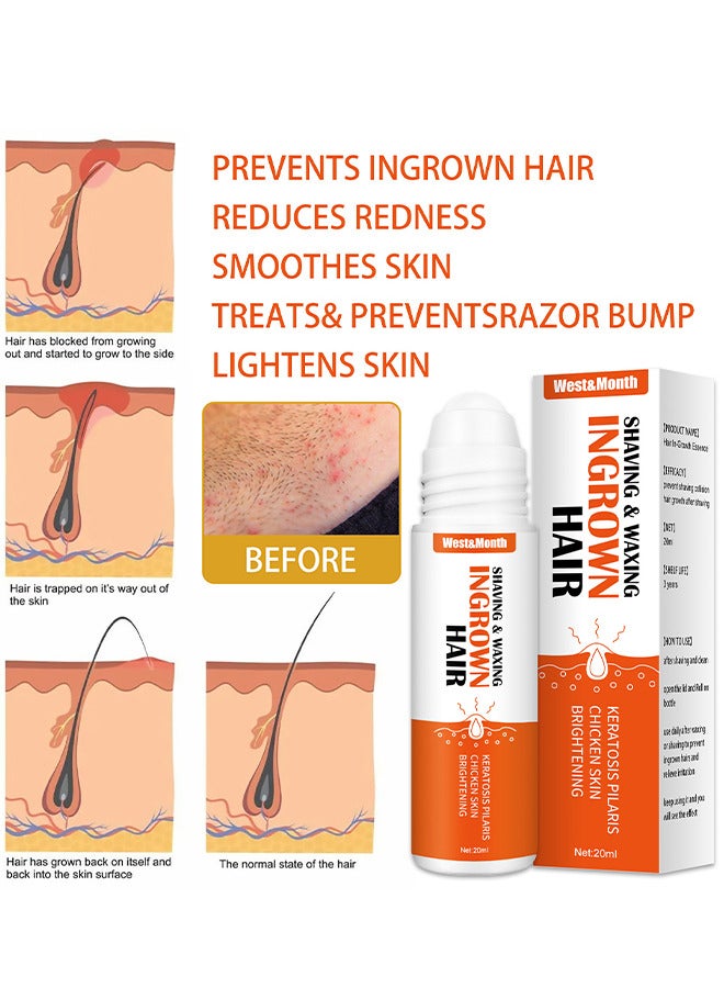 Ingrown Hair Essence Brightening Skin Get Rid Of Beard Nursing Essential Oils, Repairing Serum To Reduce Dark Spots After Shaving Gentle On Ingrown Hair