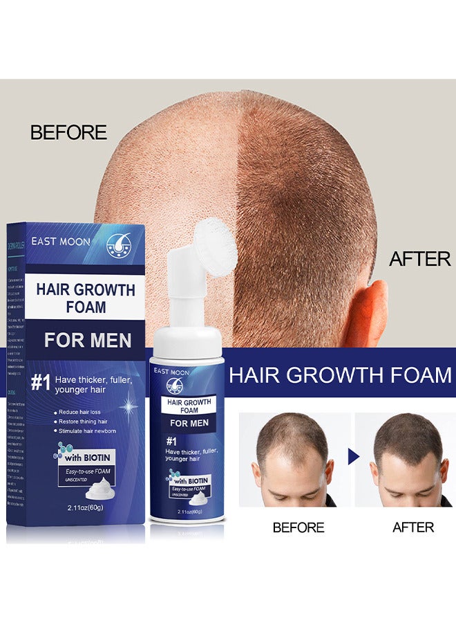 Men's Hair Regrowth Treatment Foam, For Thinning Hair, Hair Follicle, Hair Revitalizes With Topical Aerosol Revitalizes, Nurturing Scalp And Effective Hair Thickening For Men, 60G