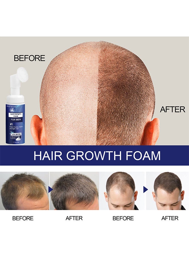 Men's Hair Regrowth Treatment Foam, For Thinning Hair, Hair Follicle, Hair Revitalizes With Topical Aerosol Revitalizes, Nurturing Scalp And Effective Hair Thickening For Men, 60G